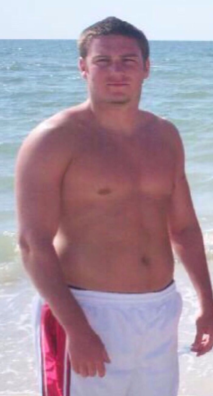 Before and After Photos Beverly Hills Plastic Surgery Gallery Los