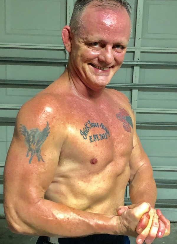 Before and After Photos Beverly Hills Plastic Surgery Gallery Los