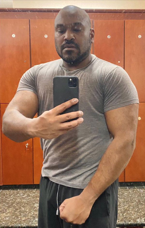 Before and After Photos Beverly Hills Plastic Surgery Gallery Los